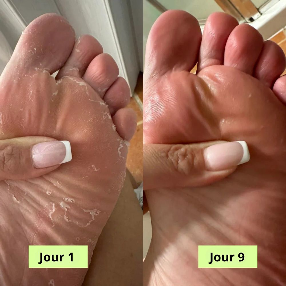Nuvea® Savon Purifiant Antifongique